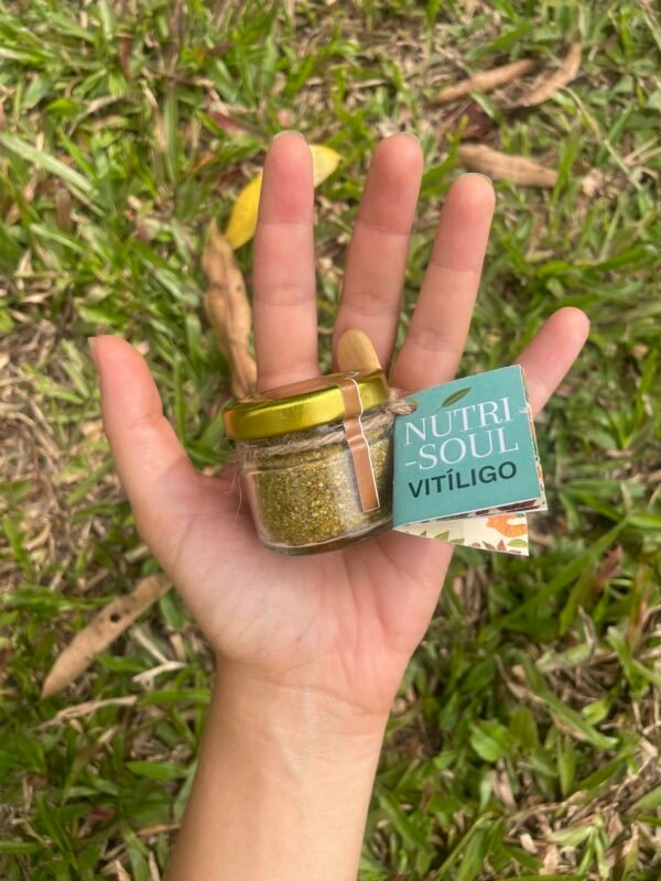 nutri-soul Vitilígo mano Nutri-Soul VITILÍGO